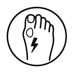 Bunions