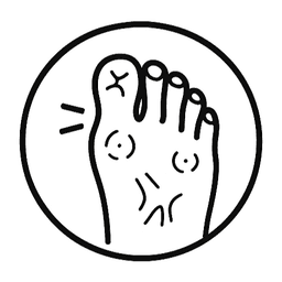 Arthritis