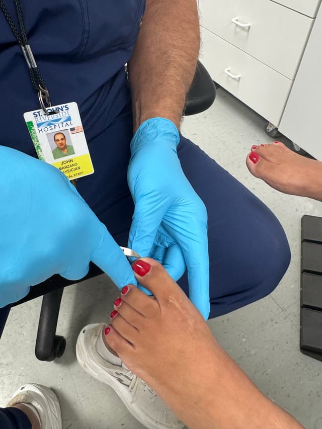 Ingrown toenail treatment in Yonkers, NY