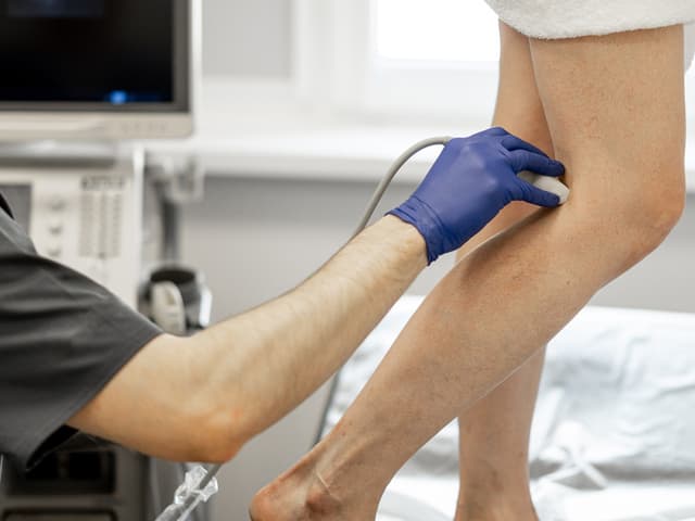 Ultrasound for varicose veins in Yonkers, NY