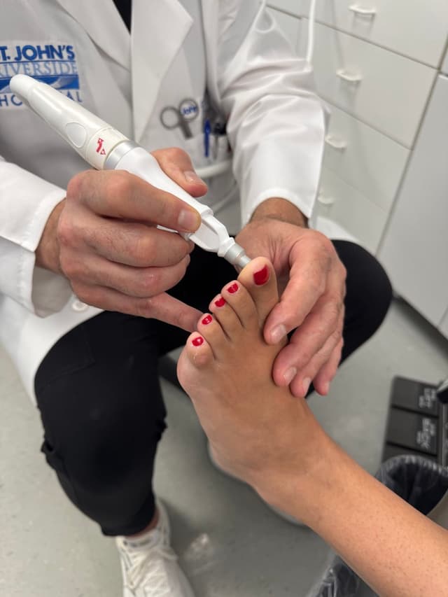 Swift laser treatment for warts in Yonkers, NY
