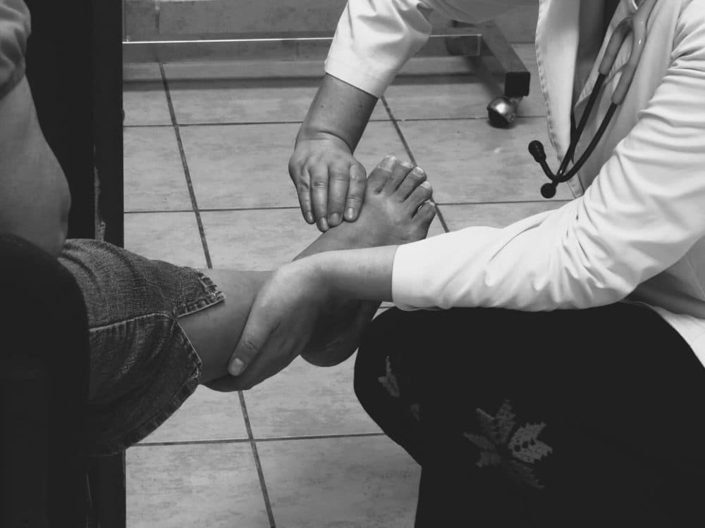 Ingrown Toenails treatment in Scarsdale, NY - Dr. John Marzano podiatrist